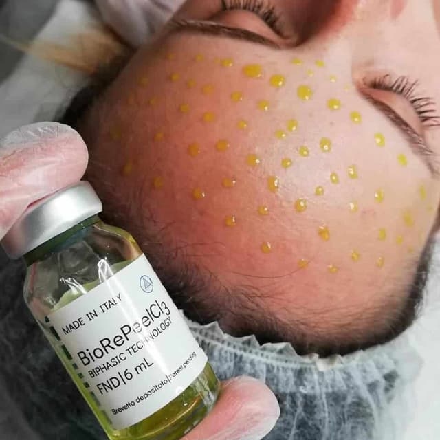 BioRePeel Reset Package at The Esty MUA in Pawtucket, RI